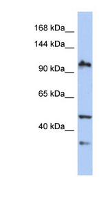 XAB2 antibody LS-C111285 Western blot of PANC1 cell lysate.