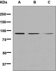 Western blot analysis on (A) Y79, (B) HeLa, and (C) K562 cell lysates using anti-XAB2 antibody.