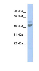 ZACN / LGICZ1 antibody LS-C110052 Western blot of NCI-H226 cell lysate.