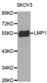 Western blot analysis of extracts of Skov-3 cell using LMP1 antibody.
