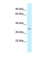 Western blot of Human NCI-H226. PDLIM7 antibody dilution 1.0 ug/ml.