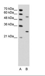 A: Marker, B: Jurkat Cell Lysate