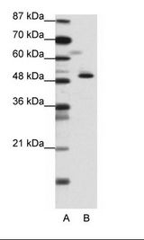 A: Marker, B: Jurkat Cell Lysate