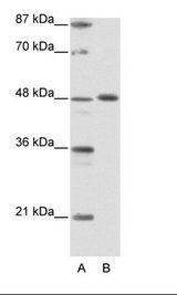 A: Marker, B: Jurkat Cell Lysate