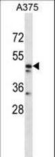 ZNF259 Antibody western blot of A375 cell line lysates (35 ug/lane). The ZNF259 antibody detected the ZNF259 protein (arrow).