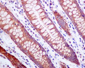 IHC of paraffin embedded human colon tissue using anti-ZNF259 antibody.