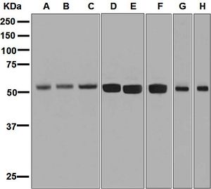 Western blot analysis on (A) human stomach, (B) fetal liver, (C) colon cancer, (D) BxPC-3, (E) HepG2, (F) Caco-2, (G) MCF-7, and (H) Jurkat lysates using anti-ZNF259 antibody.