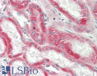 Human Kidney: Formalin-Fixed, Paraffin-Embedded (FFPE)