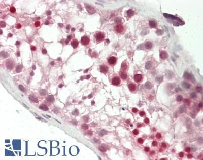 Human Testis: Formalin-Fixed, Paraffin-Embedded (FFPE)