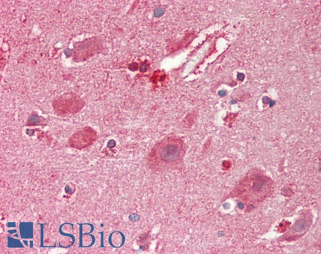 Human Brain, Cortex: Formalin-Fixed, Paraffin-Embedded (FFPE)