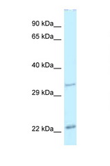 PDX1 antibody LS-B11870 Western blot of Mouse Pancreas lysate. Antibody concentration 1 ug/ml.