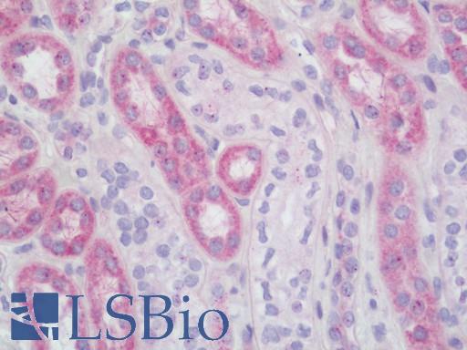 Human Kidney: Formalin-Fixed, Paraffin-Embedded (FFPE)