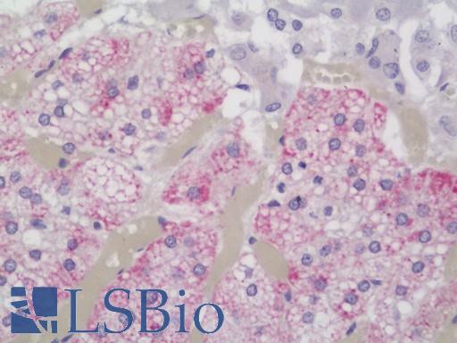 Human Adrenal: Formalin-Fixed, Paraffin-Embedded (FFPE)