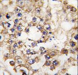Formalin-fixed and paraffin-embedded human testis tissue reacted with PDX1 Antibody , which was peroxidase-conjugated to the secondary antibody, followed by DAB staining. This data demonstrates the use of this antibody for immunohistochemistry; clinical relevance has not been evaluated.