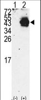 Western blot of PDX1 (arrow) using rabbit polyclonal PDX1 Antibody (RB10459). 293 cell lysates (2 ug/lane) either nontransfected (Lane 1) or transiently transfected with the PDX1 gene (Lane 2) (Origene Technologies).