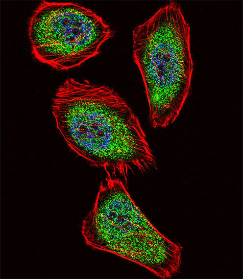 Fluorescent confocal image of U251 cell stained with IPF Antibody. U251 cells were fixed with 4% PFA (20 min), permeabilized with Triton X-100 (0.1%, 10 min), then incubated with IPF primary antibody (1:25, 1 h at 37°C). For secondary antibody, Alexa Fluor 488 conjugated donkey anti-rabbit antibody (green) was used (1:400, 50 min at 37°C). Cytoplasmic actin was counterstained with Alexa Fluor 555 (red) conjugated Phalloidin (7units/ml, 1 h at 37°C). Nuclei were counterstained with DAPI (blue) (10 ug/ml, 10 min). IPF immunoreactivity is localized to Cytoplasm and Nucleus significantly.