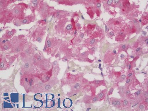 Human Adrenal: Formalin-Fixed, Paraffin-Embedded (FFPE)