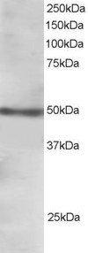Antibody staining (1.5 ug/ml) of Human Ovary extracts (RIPA buffer, 30 ug total protein per lane). Primary incubated for 1 hour. Detected by Western blot of chemiluminescence.