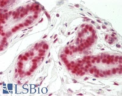Human Breast: Formalin-Fixed, Paraffin-Embedded (FFPE)