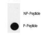 Dot blot of anti-Phospho-IPF-pT11 Antibody on nitrocellulose membrane. 50ng of Phospho-peptide or Non Phospho-peptide per dot were adsorbed. Antibody working concentrations are 0.5ug per ml.