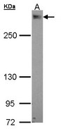 Sample (30 ug of whole cell lysate). A: A549 5% SDS PAGE. PDZD2 / PAPIN antibody diluted at 1:1000.