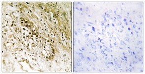 IHC of paraffin-embedded human heart tissue, using PDZD2 Antibody. The picture on the right is treated with the synthesized peptide.