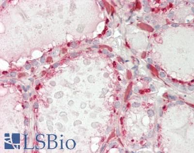 Human Thyroid: Formalin-Fixed, Paraffin-Embedded (FFPE)