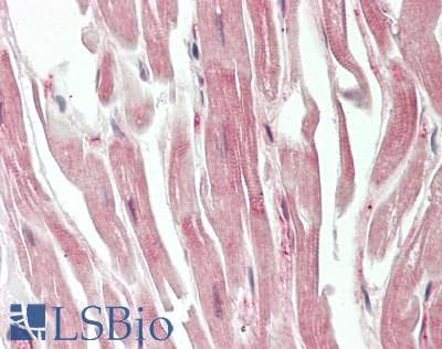 Human Heart: Formalin-Fixed, Paraffin-Embedded (FFPE)