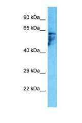 Western blot of Human HepG2. PDZD3 antibody dilution 1.0 ug/ml.