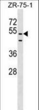 PDZD3 Antibody western blot of ZR-75-1 cell line lysates (35 ug/lane). The PDZD3 antibody detected the PDZD3 protein (arrow).