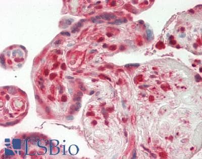 Human Placenta: Formalin-Fixed, Paraffin-Embedded (FFPE)