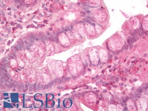 Human Small Intestine: Formalin-Fixed, Paraffin-Embedded (FFPE)