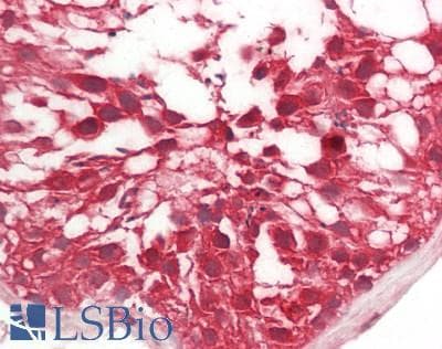 Human Testis: Formalin-Fixed, Paraffin-Embedded (FFPE)