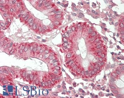 Human Colon: Formalin-Fixed, Paraffin-Embedded (FFPE)