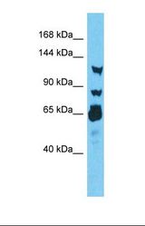 Western blot of Human Thyroid Tumor. RNF213 antibody dilution 1.0 ug/ml.