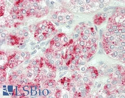 Human Adrenal: Formalin-Fixed, Paraffin-Embedded (FFPE)