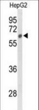 Western blot of SGSH Antibody in HepG2 cell line lysates (35 ug/lane). SGSH (arrow) was detected using the purified antibody.