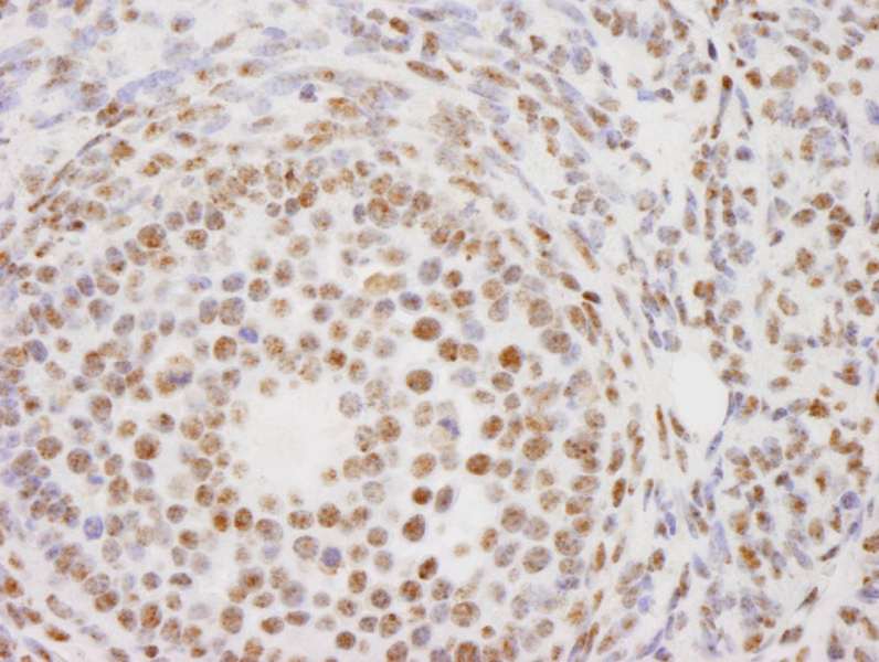 Detection of Mouse PELP1/MNAR by Immunohistochemistry. Sample: FFPE section of mouse ovary. Antibody: Affinity purified rabbit anti-PELP1/MNAR used at a dilution of 1:100. Detection: DAB.