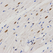 Immunohistochemistry of paraffin-embedded rat heart tissue using PELP1 antibody at dilution of 1:200 (x400 lens).