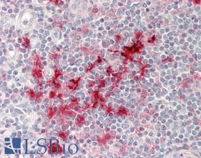 Human Tonsil: Formalin-Fixed, Paraffin-Embedded (FFPE)