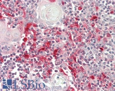 Human Thymus: Formalin-Fixed, Paraffin-Embedded (FFPE)