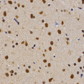 Immunohistochemistry of paraffin-embedded rat brain tissue using PELP1 antibody at dilution of 1:200 (x400 lens).