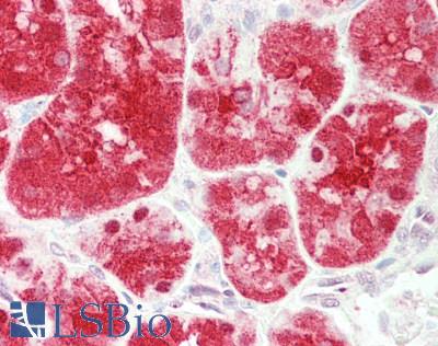 Human Kidney: Formalin-Fixed, Paraffin-Embedded (FFPE)