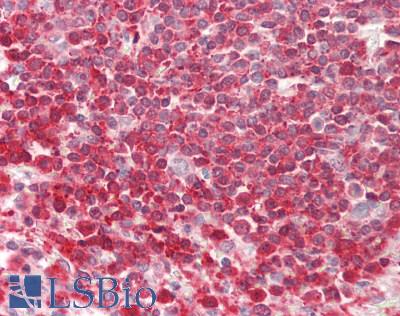 Human Spleen: Formalin-Fixed, Paraffin-Embedded (FFPE)