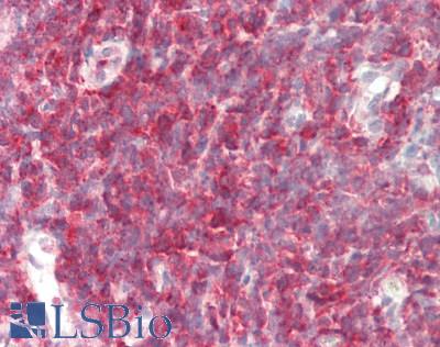 Human Tonsil: Formalin-Fixed, Paraffin-Embedded (FFPE)