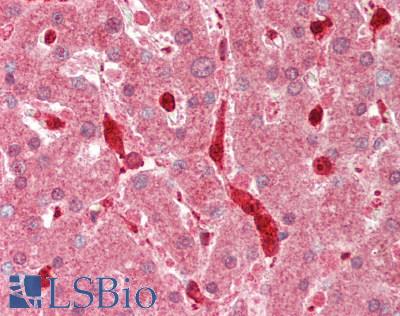 Human Liver: Formalin-Fixed, Paraffin-Embedded (FFPE)