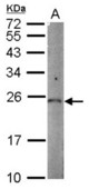 Sample (50 ug of whole cell lysate) A: mouse kidney 12% SDS PAGE PGPEP1 antibody diluted at 1:1000