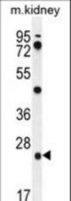 PGPEP1 Antibody western blot of mouse kidney tissue lysates (35 ug/lane). The PGPEP1 antibody detected the PGPEP1 protein (arrow).