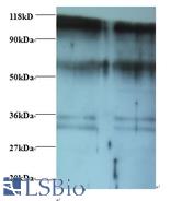 Western blot of D-3-phosphoglycerate dehydrogenase antibody at 2 ug/ml. Lane 1: EC109whole cell lysate. Lane 2: 293T whole cell lysate. Secondary: Goat polyclonal to Rabbit IgG at 1:15000 dilution. Predicted band size: 59 kDa. Observed band size: 70 kDa Additional bands at: 100 kDa. 36 kDa. We are unsure as to the identity of these extra bands.