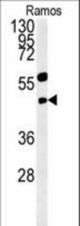 PHGDH Antibody western blot of Ramos cell line lysates (15 ug/lane). The PHGDH antibody detected the PHGDH protein (arrow).